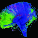 Image of Neural Pathways in a Brain